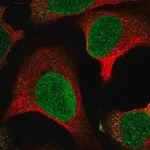 Merck Anti-MTBP antibody produced in rabbit