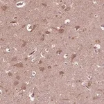 Merck Anti-ZNF292 antibody produced in rabbit