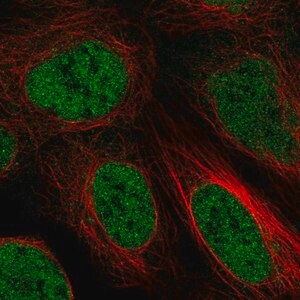 Merck Anti-ZBTB10 antibody produced in rabbit
