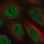 Merck Anti-ZBTB10 antibody produced in rabbit