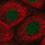 Merck Anti-TMEM94 antibody produced in rabbit