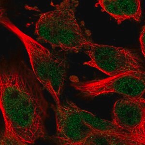 Merck Anti-ZNF655 antibody produced in rabbit