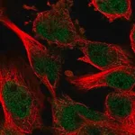 Merck Anti-ZNF655 antibody produced in rabbit