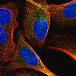 Merck Anti-NAA15 antibody produced in rabbit