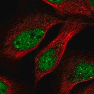 Merck Anti-TRIP4 antibody produced in rabbit