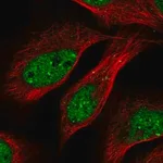 Merck Anti-TRIP4 antibody produced in rabbit