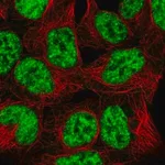 Merck Anti-SNRPB2 antibody produced in rabbit