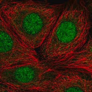 Merck Anti-RP9 antibody produced in rabbit