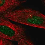Merck Anti-CAMK2N2 antibody produced in rabbit