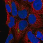 Merck Anti-C9orf85 antibody produced in rabbit
