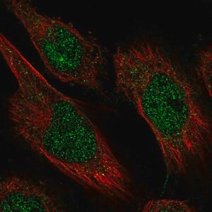 Merck Anti-CAMTA2 antibody produced in rabbit