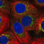 Merck Anti-MATN3 antibody produced in rabbit