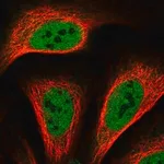 Merck Anti-TRERF1 antibody produced in rabbit