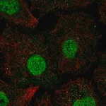 Merck Anti-SMAD6 antibody produced in rabbit