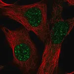 Merck Anti-TMEM179B antibody produced in rabbit