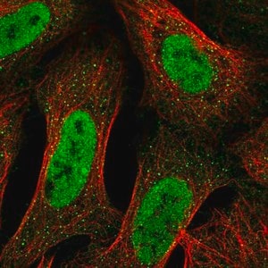 Merck Anti-TRAK2 antibody produced in rabbit