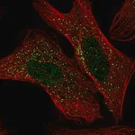 Merck Anti-ADAM32 antibody produced in rabbit