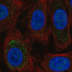 Merck Anti-TRPC6 antibody produced in rabbit