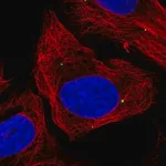 Merck Anti-DMRTA1 antibody produced in rabbit