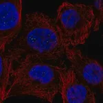 Merck Anti-PPM1M antibody produced in rabbit