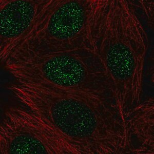 Merck Anti-CBFA2T3 antibody produced in rabbit