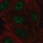 Merck Anti-CBFA2T3 antibody produced in rabbit