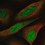 Merck Anti-CCDC3 antibody produced in rabbit