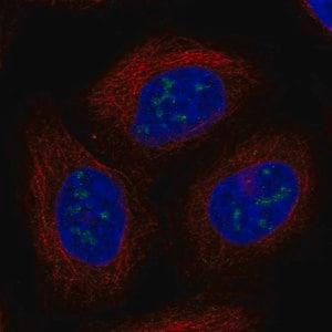 Merck Anti-UBE2W antibody produced in rabbit