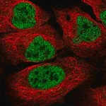 Merck Anti-LTBP3 antibody produced in rabbit