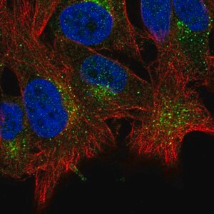 Merck Anti-ABHD6 antibody produced in rabbit