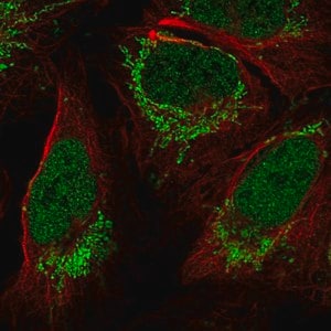 Merck Anti-FOXB1 antibody produced in rabbit