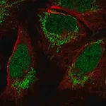 Merck Anti-FOXB1 antibody produced in rabbit