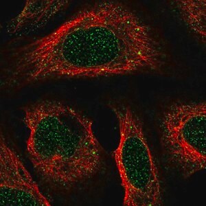 Merck Anti-ACKR2 antibody produced in rabbit