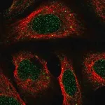 Merck Anti-ACKR2 antibody produced in rabbit