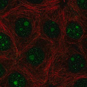 Merck Anti-PAQR6 antibody produced in rabbit