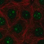 Merck Anti-PAQR6 antibody produced in rabbit
