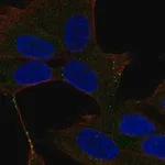 Merck Anti-UNC13D antibody produced in rabbit