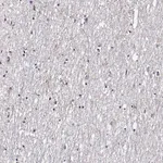 Merck Anti-FEZF1 antibody produced in rabbit