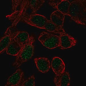 Merck Anti-SOX18 antibody produced in rabbit