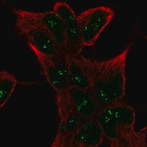 Merck Anti-SESN1 antibody produced in rabbit