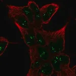Merck Anti-SESN1 antibody produced in rabbit