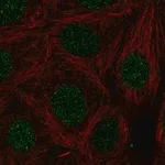 Merck Anti-LMX1B antibody produced in rabbit