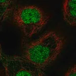 Merck Anti-ETS2 antibody produced in rabbit