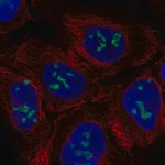 Merck Anti-RIOX1 antibody produced in rabbit