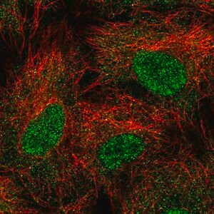 Merck Anti-UBE2B antibody produced in rabbit