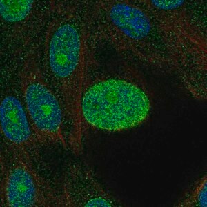 Merck Anti-CDK4 antibody produced in rabbit