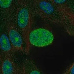 Merck Anti-CDK4 antibody produced in rabbit