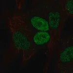 Merck Anti-PRRX2 antibody produced in rabbit
