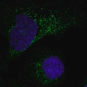 Merck Anti-MMP1 antibody produced in rabbit