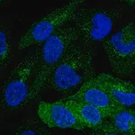 Merck Anti-PKLR antibody produced in rabbit